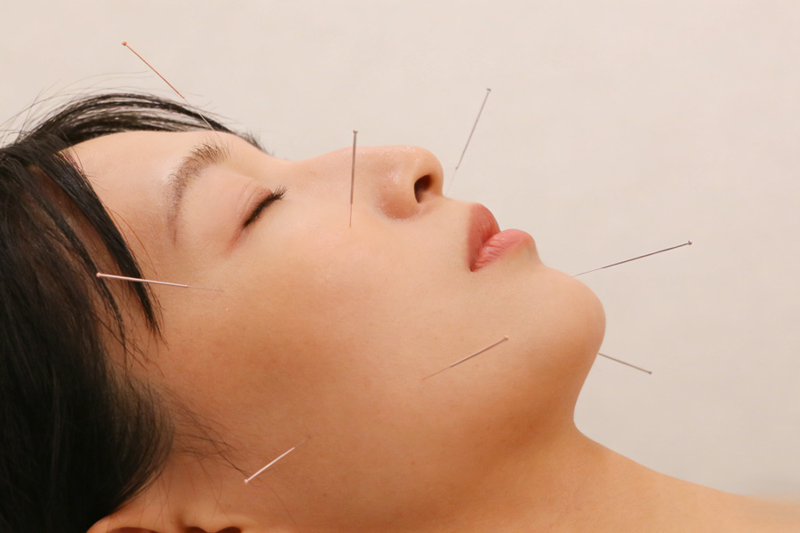 FACIAL REJUVENATION ACUPUNCTURE